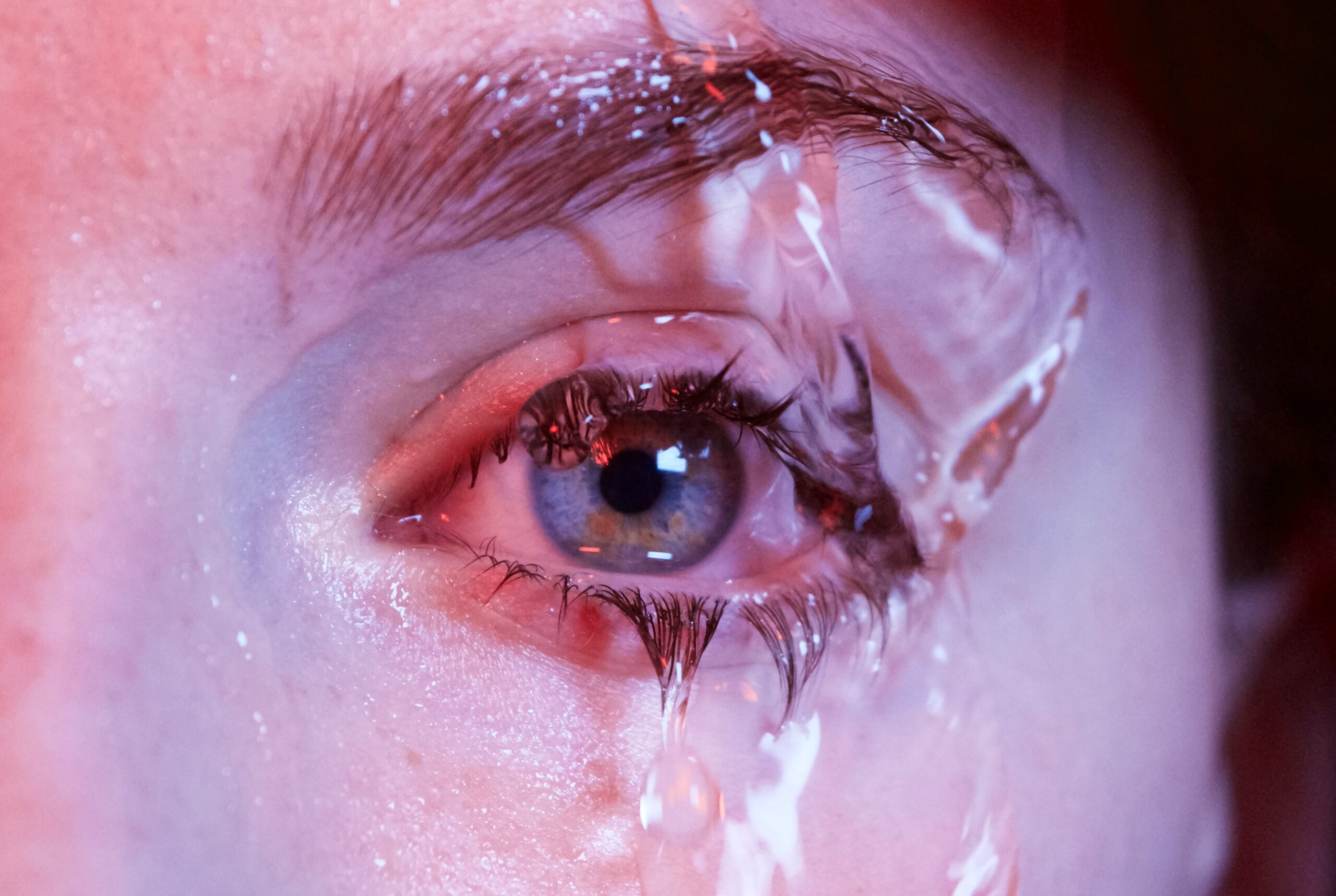 Pink eye with water dropping