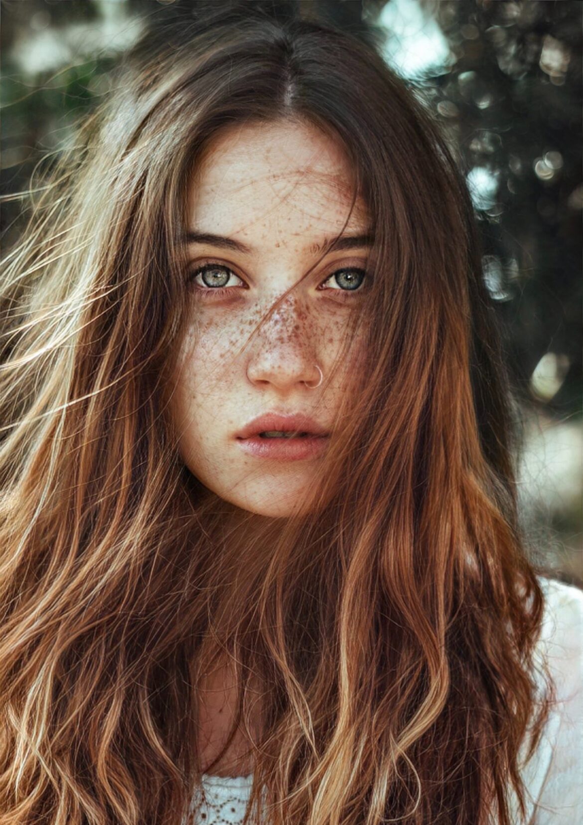 freckles treatment