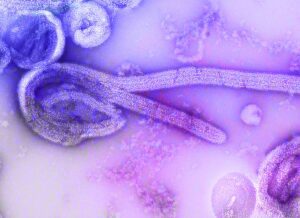 Ebola Virus Disease (EVD)